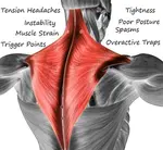 trapezius muscle pain 411 opt dec 24