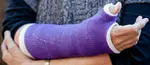 wrist fracture cast 702 opt feb 25