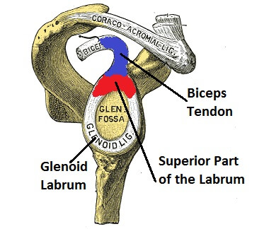 SLAP Tear: Superior labral anterior to posterior tear of the shoulder SLAP Tear: Superior labral anterior to posterior tear of the shoulder