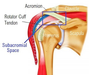 Pain On Top Of Shoulder: Causes Treatment - Shoulder Explained