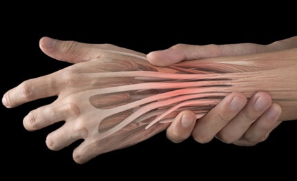 Pain In Back Of Hand from Extensor Tendon Injuries: causes, symptoms, diagnosis & treatment