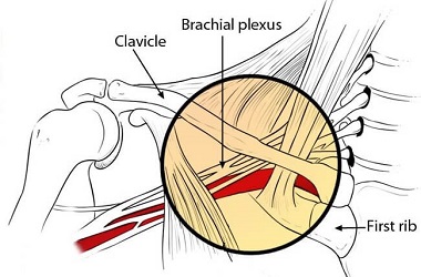 5 COMMON CAUSES OF PAIN UNDER YOUR SHOULDER BLADE