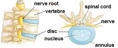Structure of the spine and intervertebral discs. Nerve and spinal problems are a common cause of burning shoulder pain
