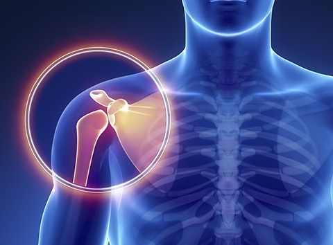 Shoulder Pain And Disability Index Reliability And Validity thumbnail