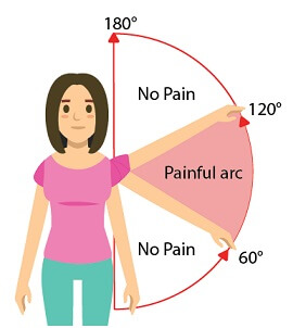Shoulder Pain When Lifting Arm: Causes & Treatment