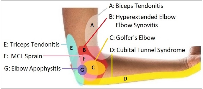 Elbow Diagnosis Chart