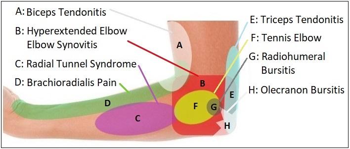 Elbow Diagnosis Chart