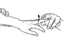 Test For Radial Tunnel Syndrome: Maudley's Test
