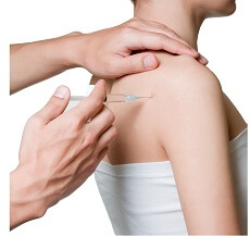 Steroid injections can be a useful frozen shoulder treatment to reduce pain and inflammation