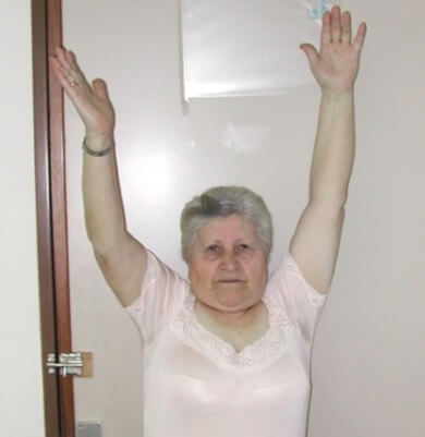 Shoulder range following a hemiarthroplasty for a proximal humeral fracture. Range of movement is slightly reduced on the affected arm but it will within the function range