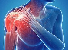https://www.shoulder-pain-explained.com/images/shoulder-pain-causes-link.jpg