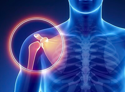 Shoulder Pain Explained: Shoulder Pain Diagnosis. Find out what is causing your shoulder pain