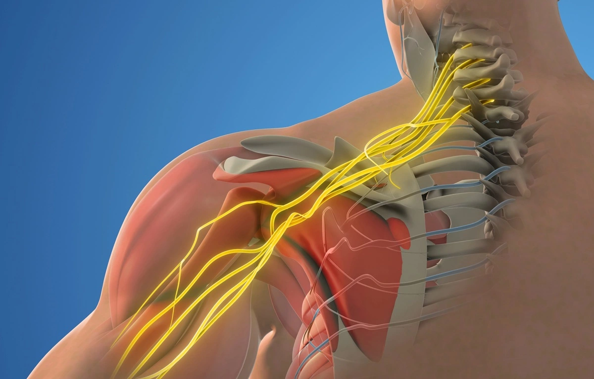 How neck problems can cause shoulder pain. The nerves leave the spinal cord through openings in the neck and travel across the shoulder and down the arm to the hand