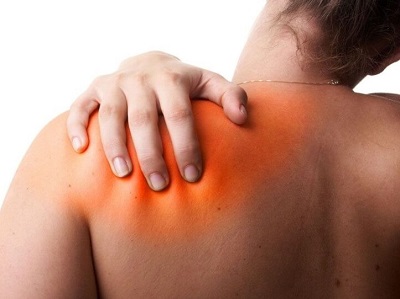 Scapulothoracic Bursitis Aka Snapping Scapula Syndrome