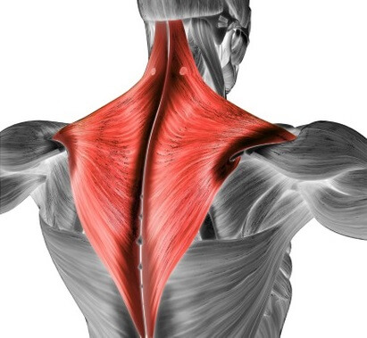 Trapezius muscle pain & trigger points