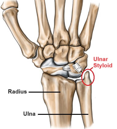 Ulnar Styloid Process: The forearm is made up of two bones, the radius and ulna. On the end of the ulna is a small, pointy bony projection known as the ulnar styloid process
