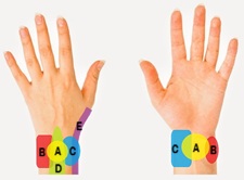 Wrist Pain Diagnosis Chart Diagram: Find out what is causing your wrist pain